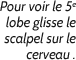 Glisse le scalpel pour ouvrir le cerveau